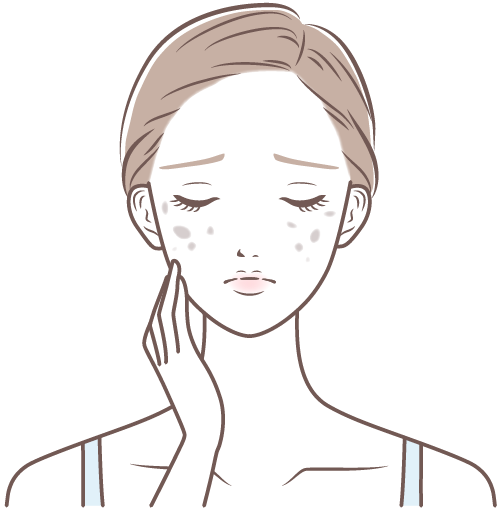 シミで悩む女性のイラスト